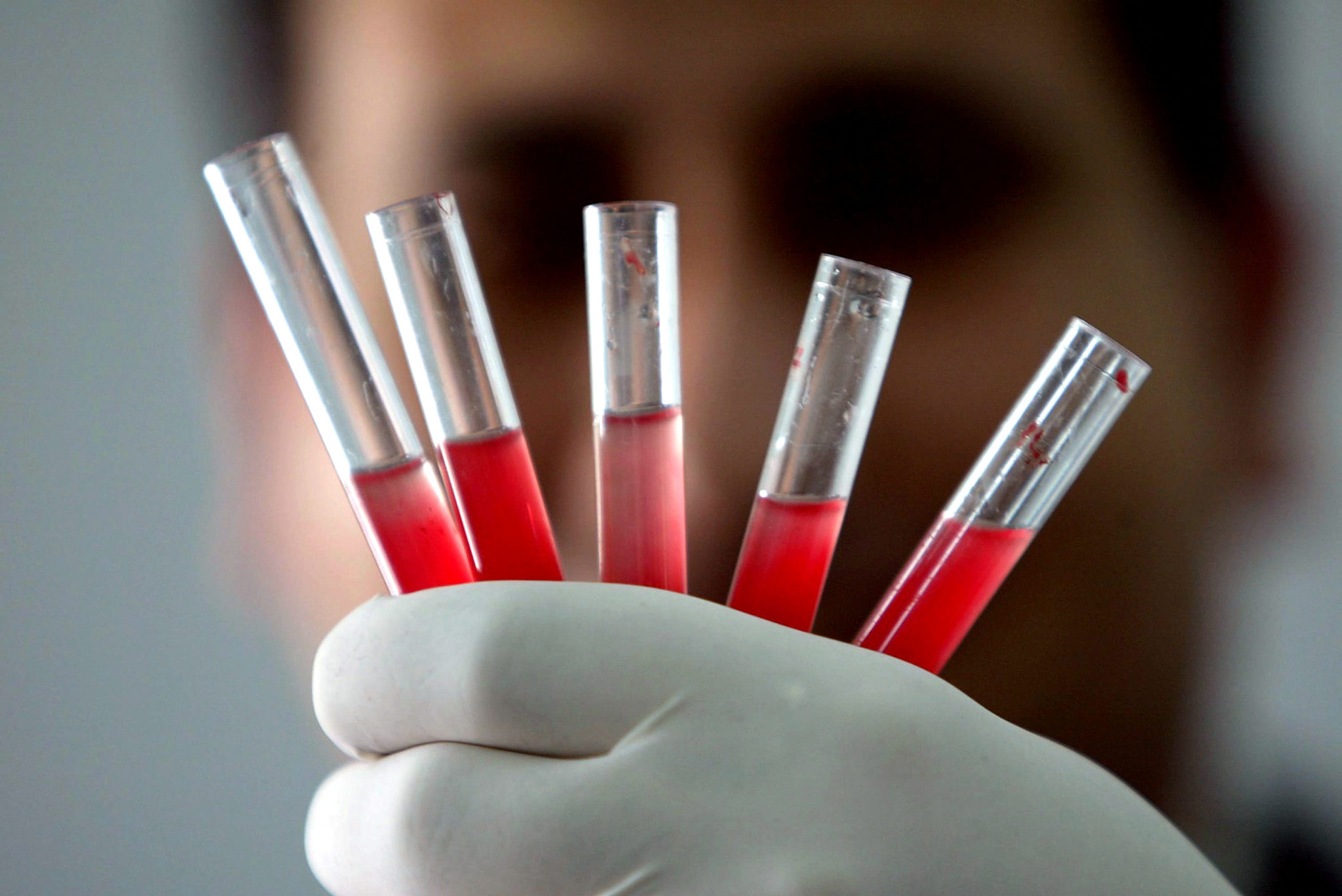 What Is The Rarest Blood Type Is O Negative A Rare Blood Type   Rarest Blood Type Scaled 